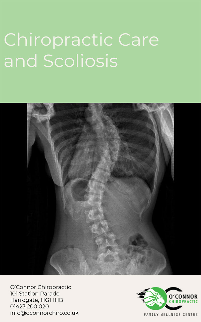 Chiropractic Care and Scoliosis